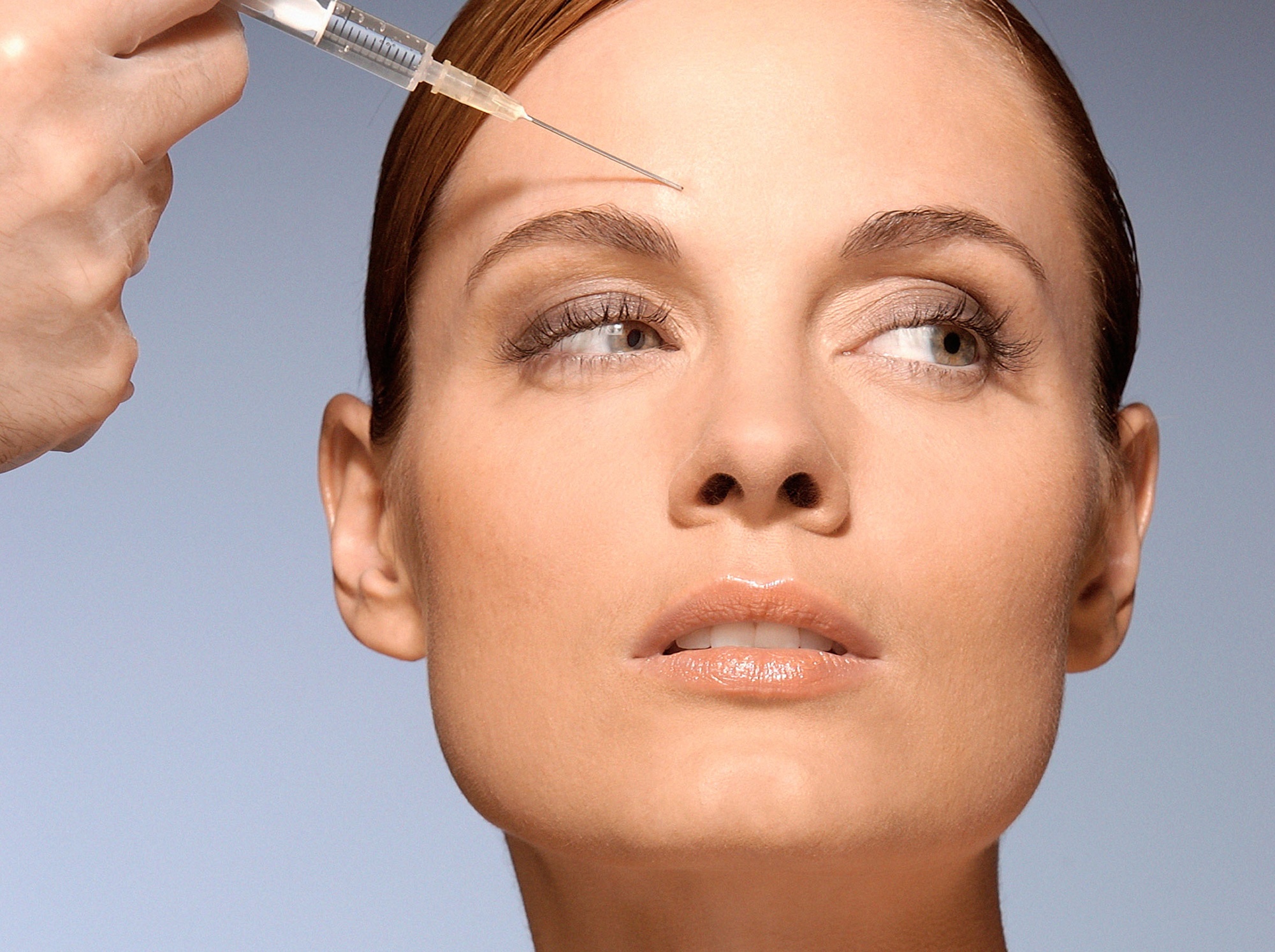 What areas of the face can facial fillers improve?