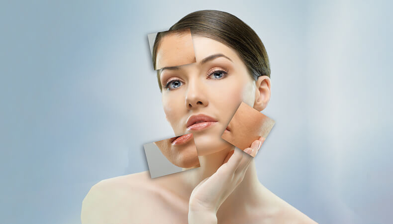 Why not book a skin peel to reduce the stress of the New Year?